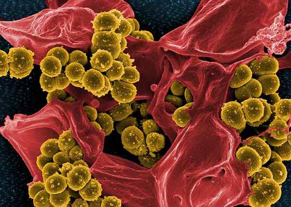 10 vorteilhafte Bakterien für menschliches Wesen und Eigenschaften