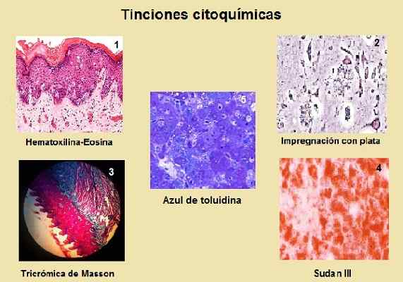 Histoire de la cytochimie, objet d'étude, utilité et techniques