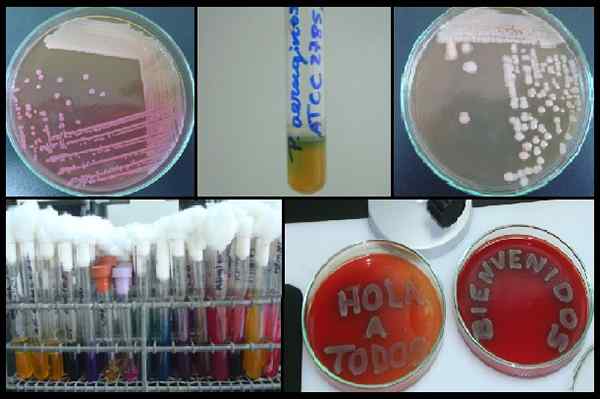 Bacteriekweektypen, kenmerken, methoden, vereisten