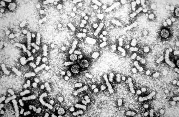 Hepadnavirus -Eigenschaften, Morphologie, Behandlung
