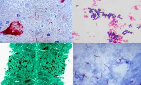 Histochemistry Foundation, verwerking, vlekken