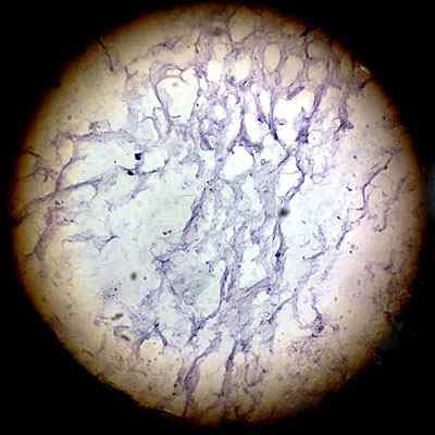 Características do tecido conjuntivo laxo, histologia, tipos, funções