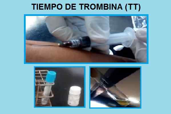 Bromise Time Foundation, Procedure, Pathologies