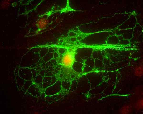 Oligodendrozyteneigenschaften, Typen und Funktionen