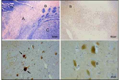 Fonctions de substance noire, anatomie et maladies