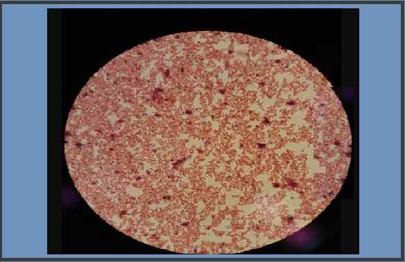 Agggatibacter actinomycemcomitans Caractéristiques, morphologie, culture