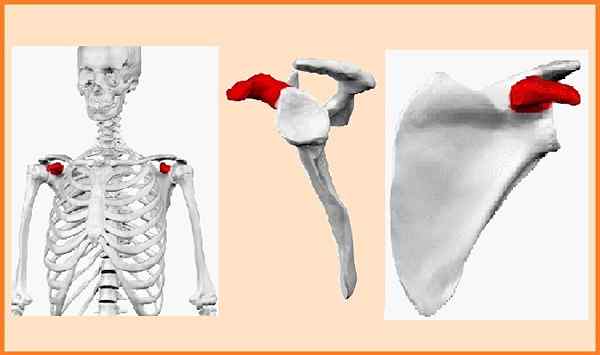 Charakteristiky Coracoid apoisis, funkcia, poruchy