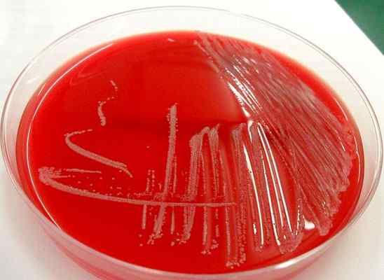 Gram positieve bacterie -kenmerken, structuur, ziekten