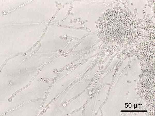 Blastoconidias gjær, sykdommer, diagnose, behandlinger