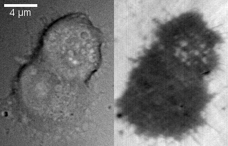 Cromafin -cellen kenmerken, histologie, functies