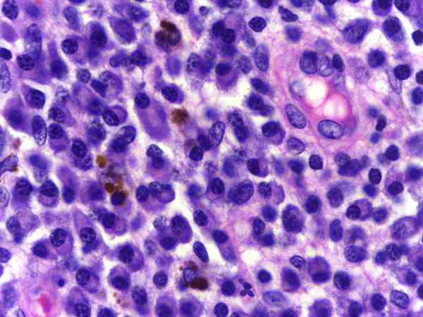 Características, funções e doenças das células plasmáticas