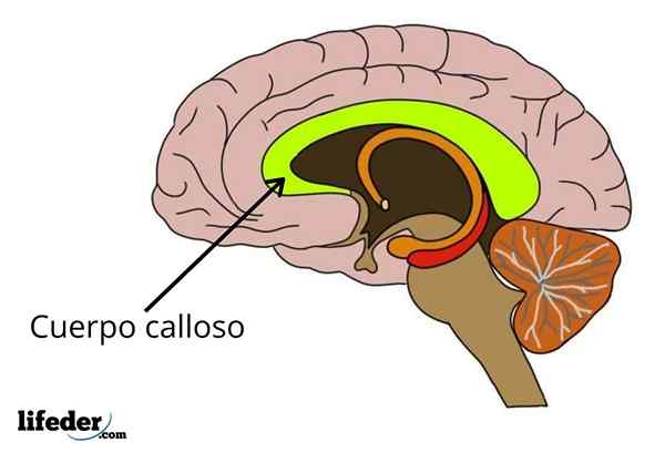 Fonction du corps de Calloso, parties, maladies