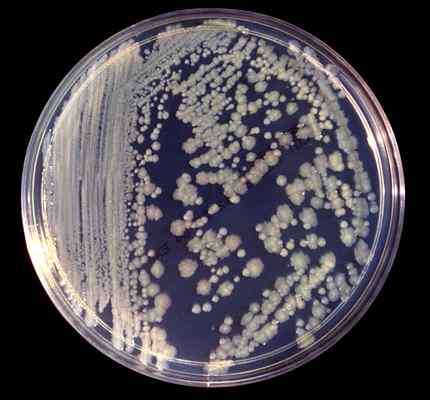 Enterobacter Cloacae -Eigenschaften, Morphologie, Krankheiten