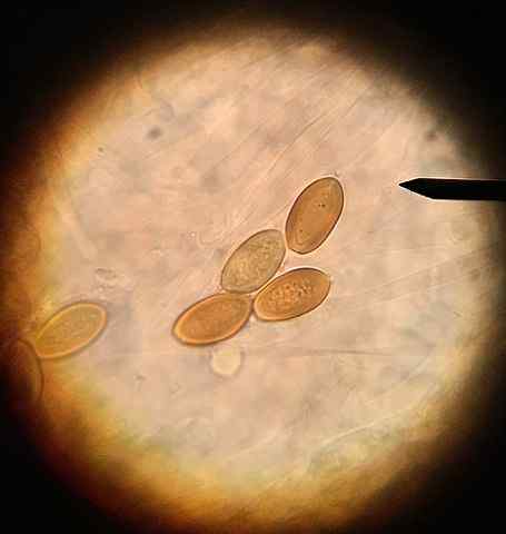 Caractéristiques et spores de types