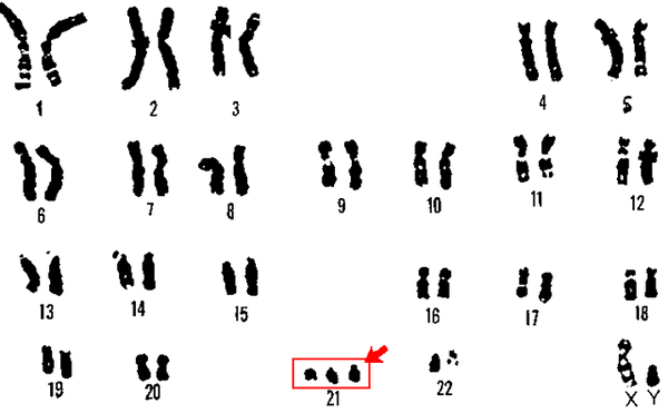 Punca dan jenis mutasi genomik (dengan contoh)