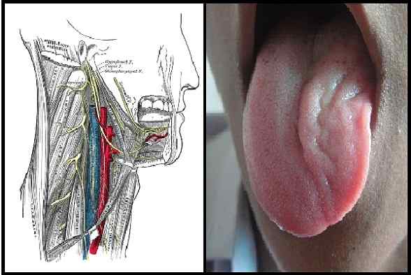 Hypogloso nervový pôvod, cesta, funkcie, patológie