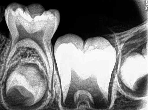 Odontogenessteg och dess egenskaper