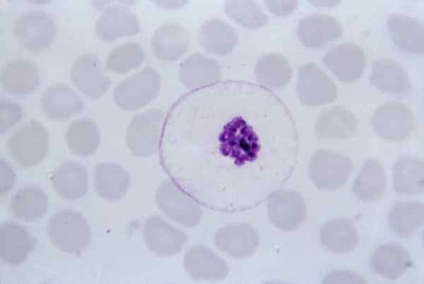 Charakterystyka Plasmodium malariae, morfologia, cykl życia