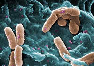 Ciri -ciri Pseudomonas Aeruginosa, Morfologi, Kitaran Hidup, Penularan