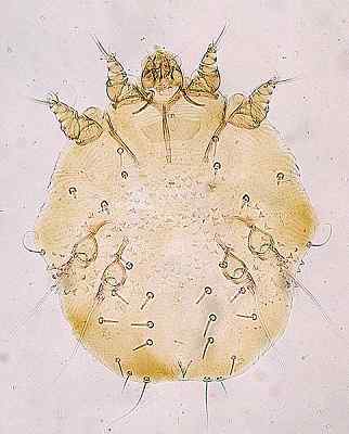 Sarcoptes scabiei Ciri -ciri, morfologi, penghantaran, gejala