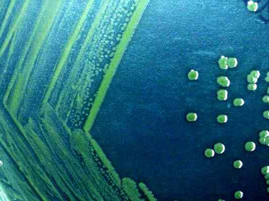 Shigella Sonnei -Eigenschaften, Morphologie, Lebenszyklus, Krankheiten