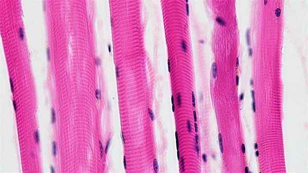 Charakteristiky svalovej tkaniny, funkcie, typy, bunky