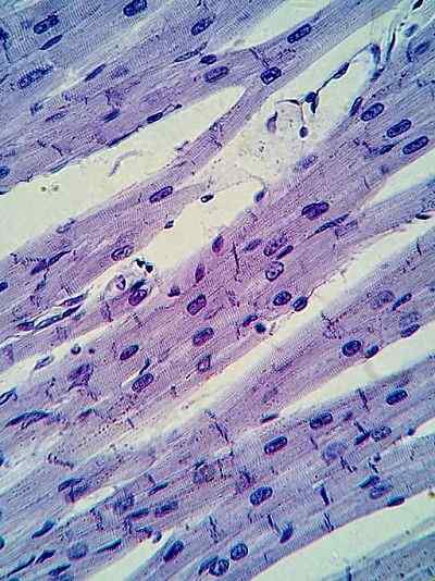 Hartspierweefselkenmerken, functies, histologie