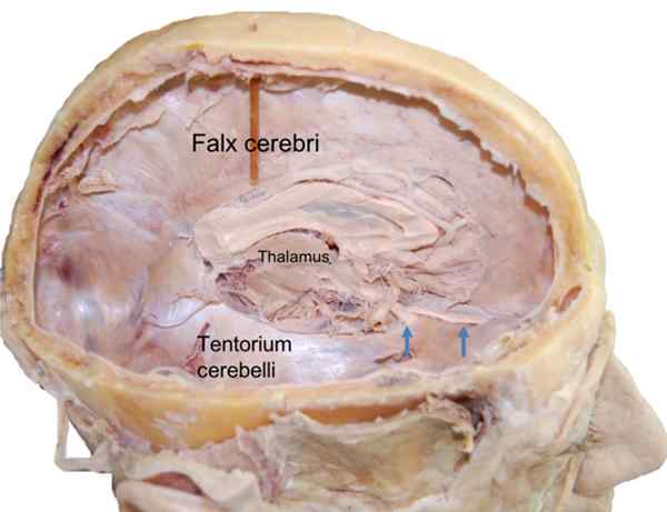 Emplacement du magasin de cervelet, anatomie, insertions, fonction