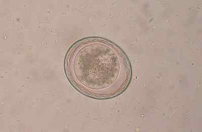 Toxascaris Leonina Caractéristiques, morphologie, symptômes d'infection