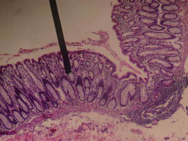 Histologie in Houston, functies, ziektekleppen