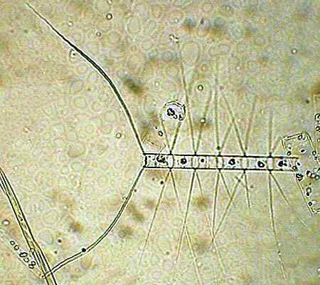 Caractéristiques unicellulaires des algues et exemples d'espèces