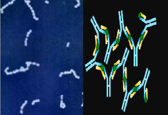 Antisteptolisin ou quantification, fondation, technique, pathologies