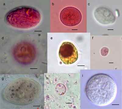 Chilomastix menili caractéristiques, morphologie, cycle biologique