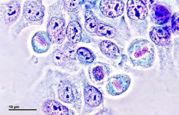 História HeLa Cells, charakteristiky, bunkový cyklus a použitia