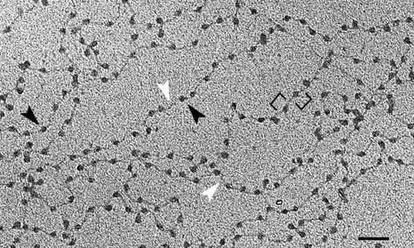 Chromatinetypen, kenmerken, structuur, functies