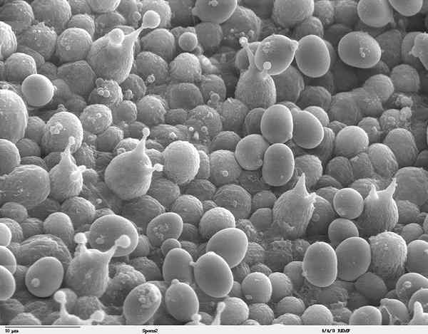 Caractéristiques des endospores, structure, formation, fonctions