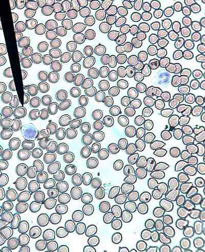 Erythropoese -Stadien und ihre Eigenschaften, Regulierung, Animulation