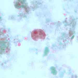 Jodamoba bütschlii -egenskaper, morfologi, biologisk cykel