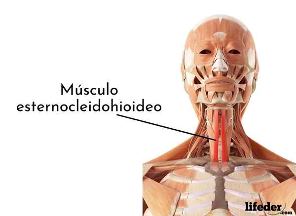 Sternocleidahioideo mišica