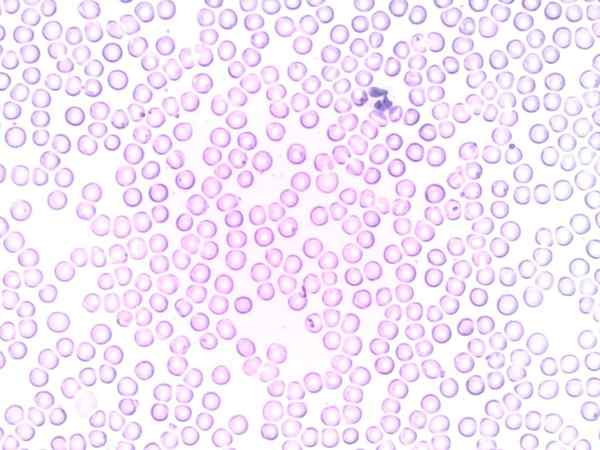 Neutrophileneigenschaften, Morphologie, Funktionen, Typen