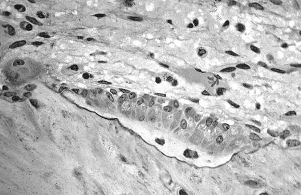 Formation des ostéoblastes, caractéristiques, fonctions, pathologies