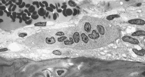 Osteoclasten training, kenmerken, functies, ziekten