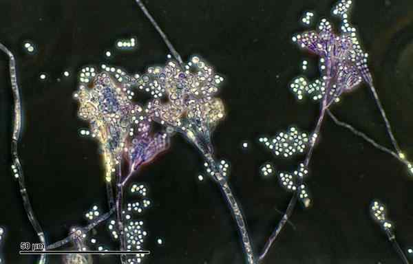 Penicillium -egenskaper, morfologi, livsmiljö, reproduktion