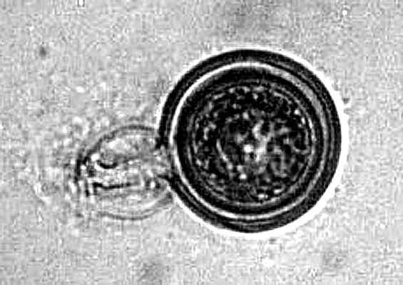 Karakteristik Phytophthora Infestans, Nutrisi, Gejala