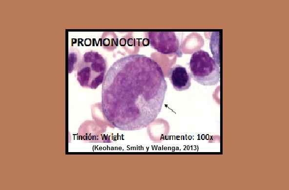 PROMOCITO MORFOLOGY, IDENTIFIKASJON, PATHOGIER