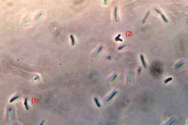 Proteus mirabilis Egenskaper, morfologi, smitta, symtom