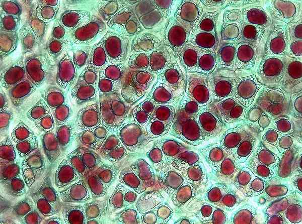 Wat zijn chromoplasses?