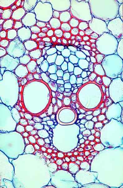 Posizione, caratteristiche e funzioni dei tracheidi