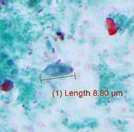 Trichomonas hominis Caractéristiques, morphologie, cycle biologique