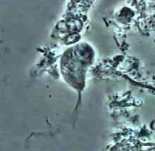 Trichomonas Tenax -Eigenschaften, Morphologie, Lebenszyklus